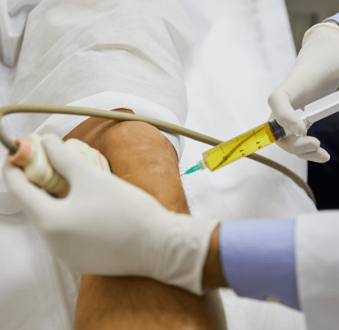 PRP ve Kök Hücre Tedavileri