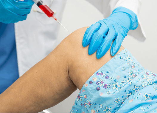 PRP ve Kök Hücre Tedavisi ile İyileşme Süreci